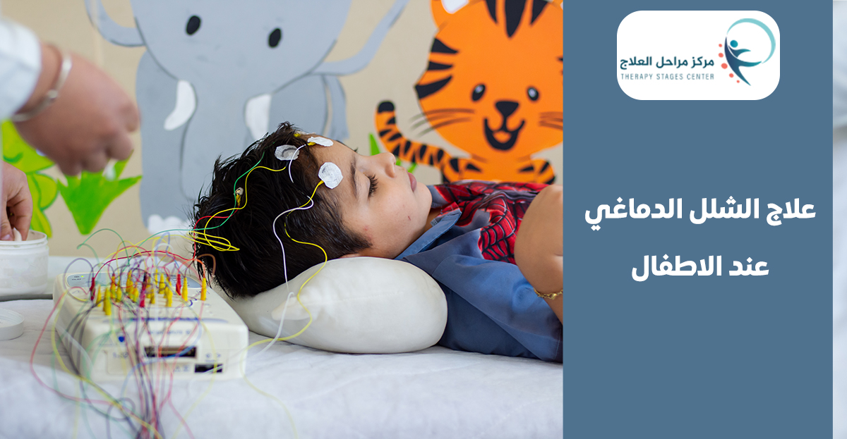 أهم ما تحتاج أن تعرفه عن علاج الشلل الدماغي عند الاطفال