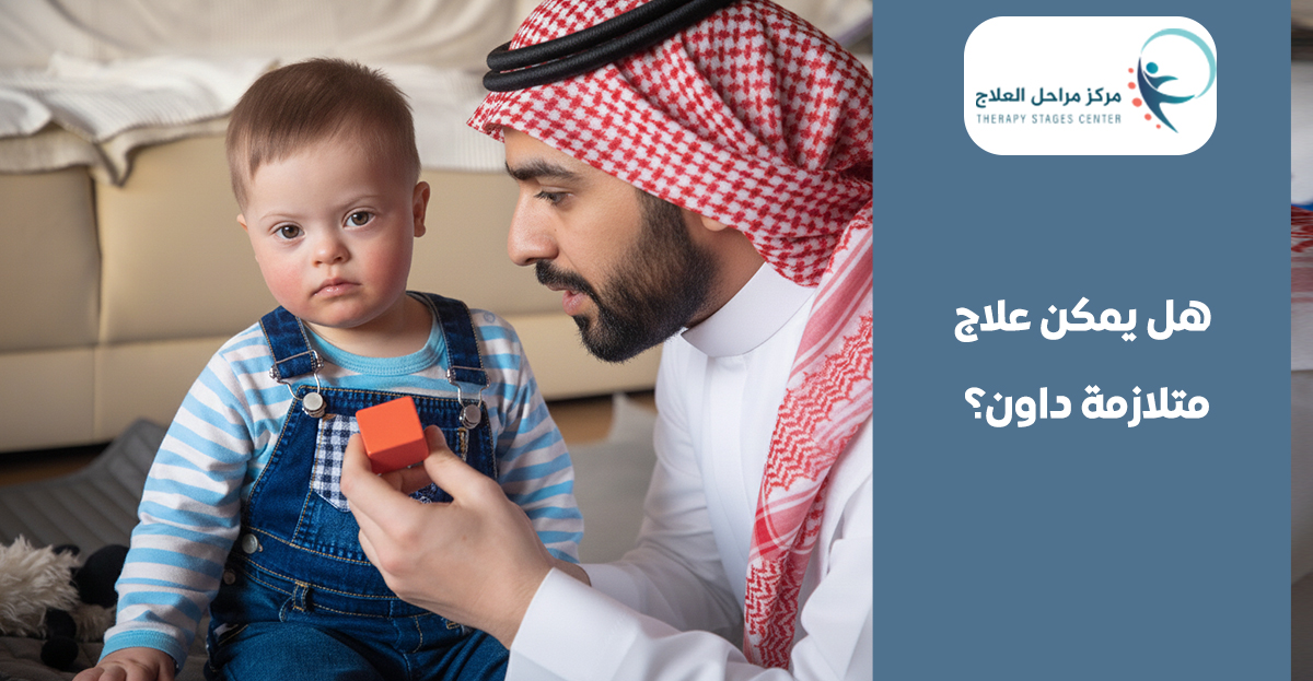 علاج متلازمة داون